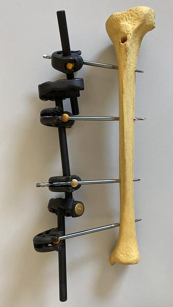 Аппарат внешней фиксации стержневой фото 1