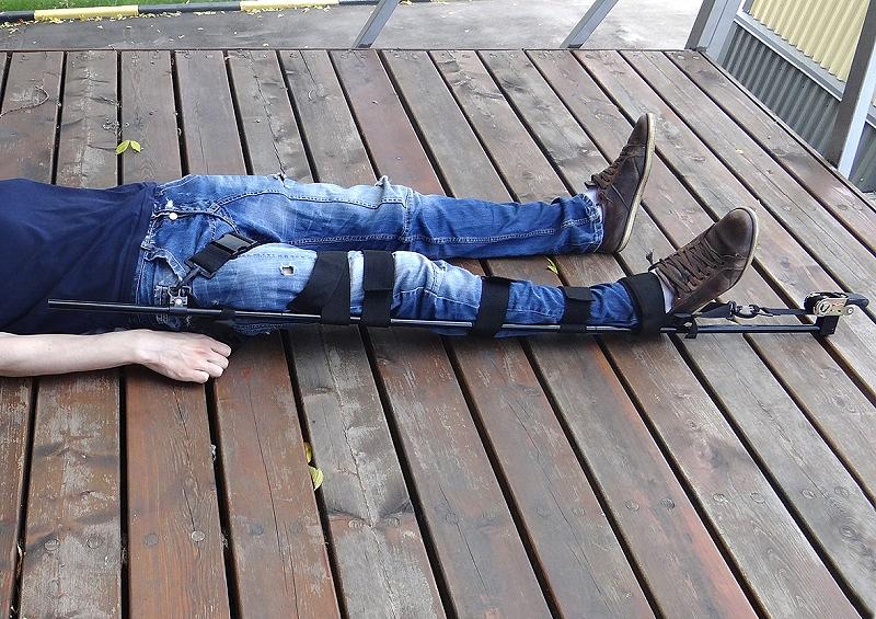 Шина тракционная для вытяжения нижней конечности при переломе со смещением ШТС-01-«МЕДПЛАНТ» фото 4