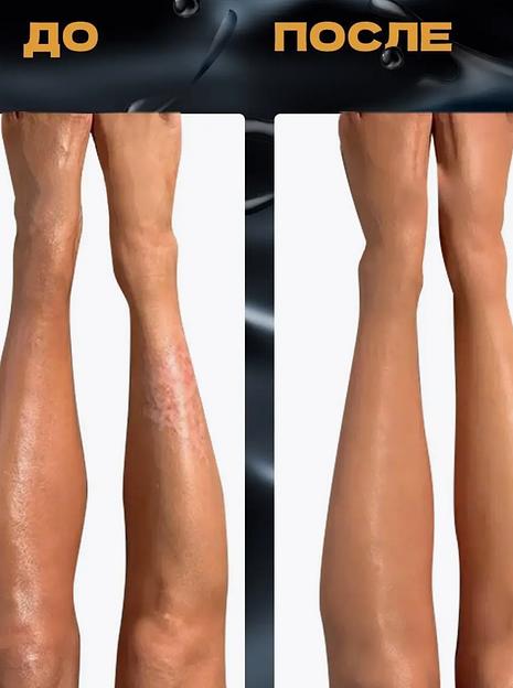 Крем нафталановый Azerfarm 25 г ОПТ фото 10