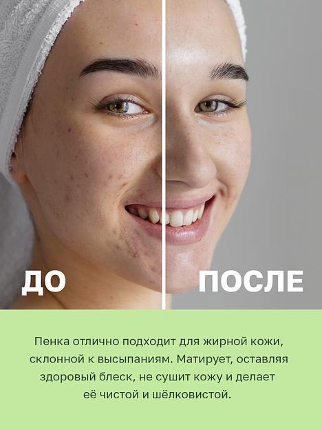 Пенка для умывания лица для жирной и комбинированной кожи 150 мл ОПТ фото 5