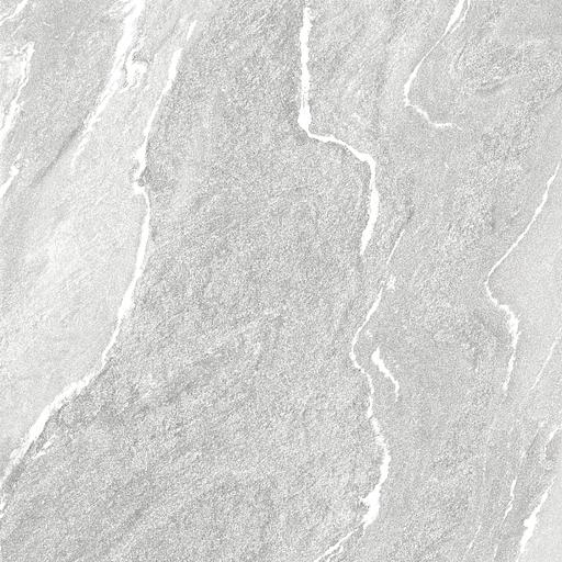 Керамогранит Alma Ceramica Nexstone GFU57NXT07R 570x570 фото 1